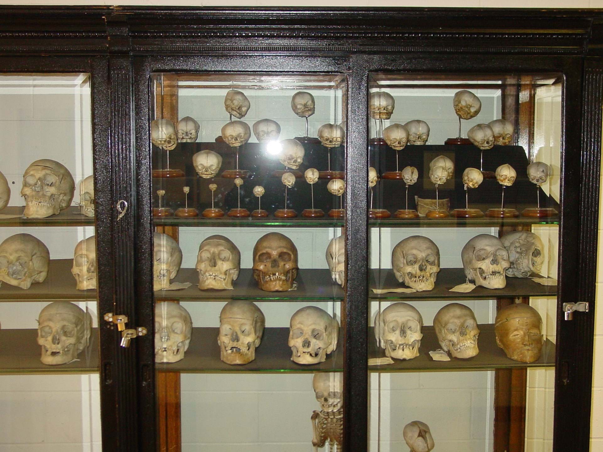 Osteological Collection